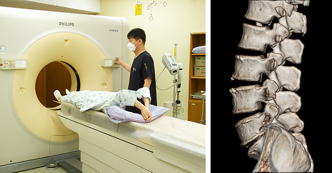 CT Scans