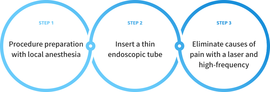 STEP1 - Procedure preparation with local anesthesia, STEP2 - Insert a thin endoscopic tube, STEP3 - Eliminate causes of pain with a laser and high-frequency
