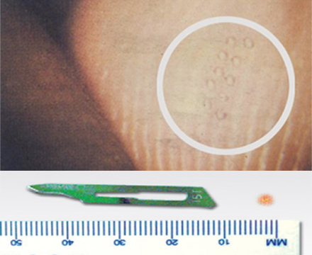 The laser is fine enough to make a 0.3mm diameter mark between fingerprints