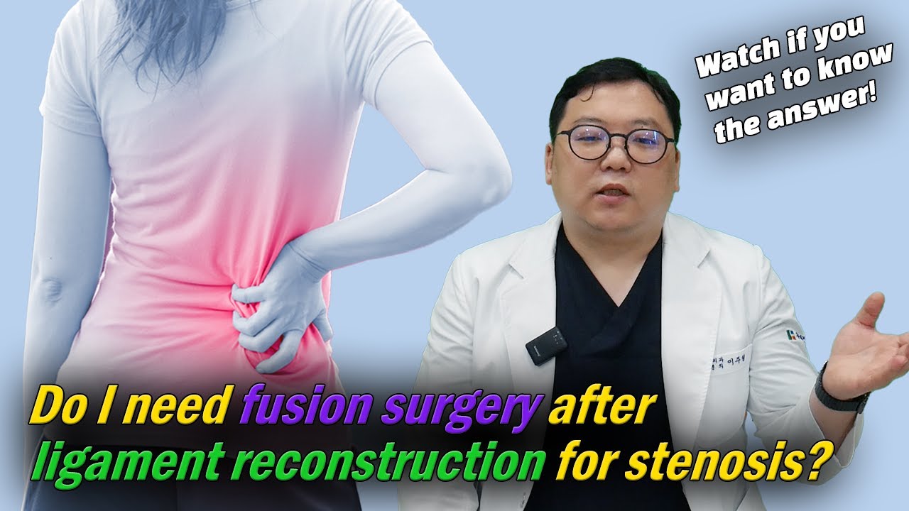 Do you need interbody fusion surgery after ligament reconstruction for spinal stenosis?