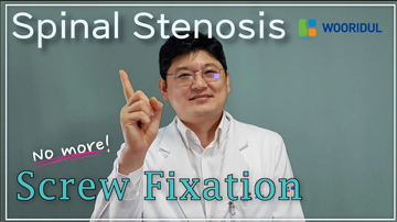 Best treatment for Spinal Stenosis