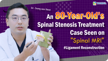 Can Spinal Stenosis Be Treated Even Over the Age of 80?