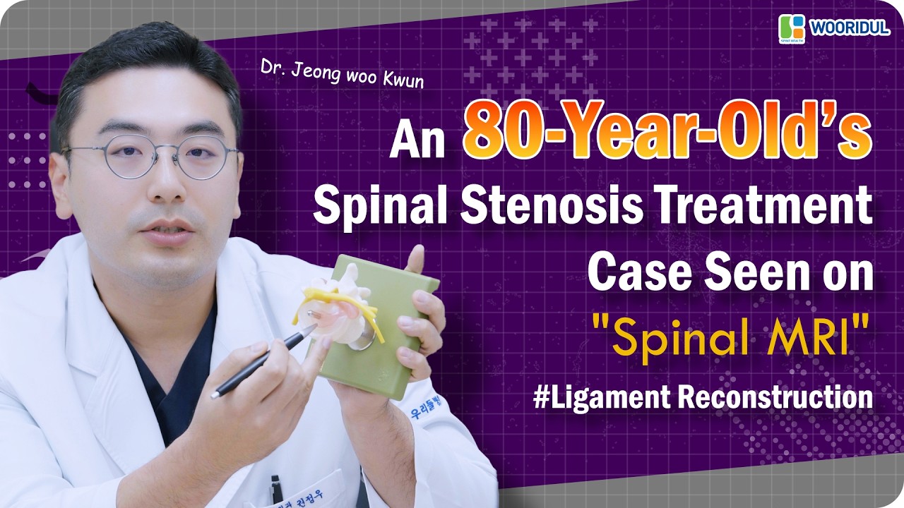 Can Spinal Stenosis Be Treated Even Over the Age of 80?
