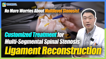 Paradigm Shift in Multilevel Spinal Fusion